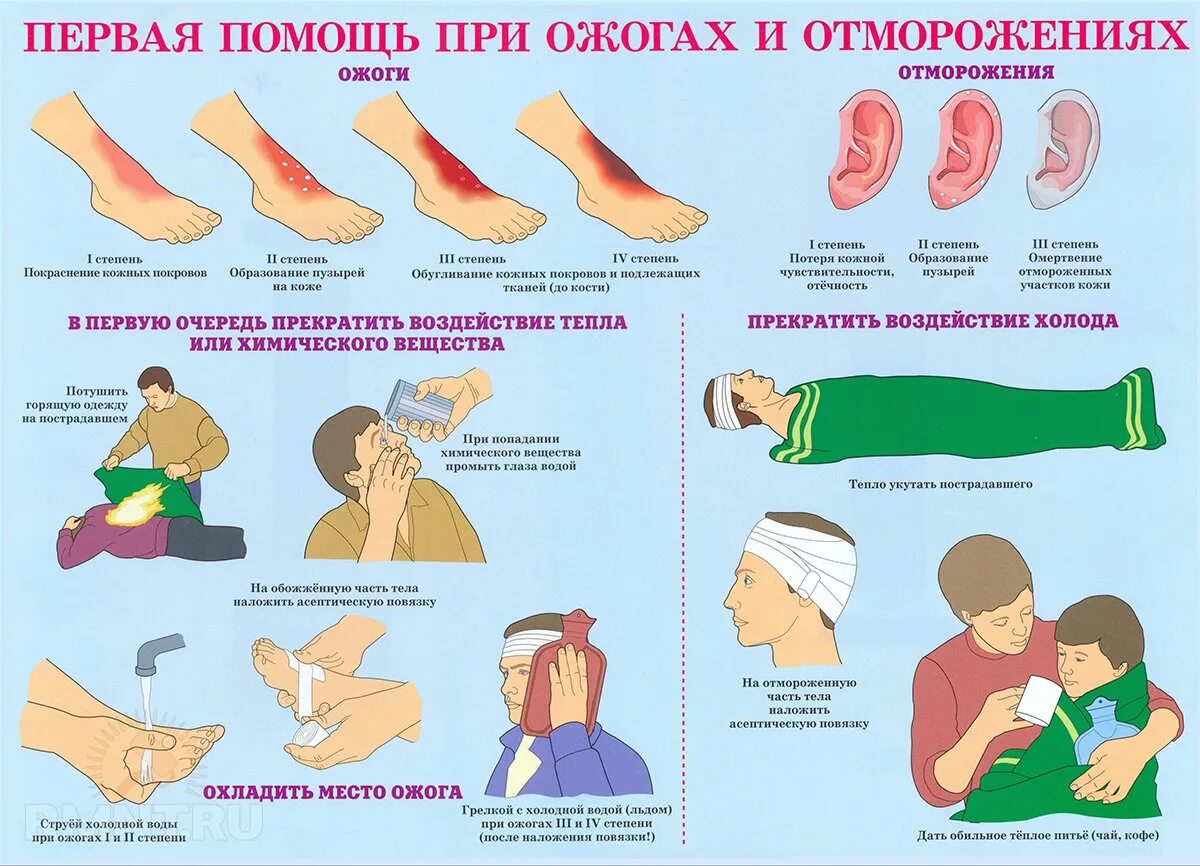 Правила оказания доврачебной помощи. Оказание первой неотложной помощи при ожогах. правила первой помощи при ожогах. правила оказания первой медицинской помощи при ожогах. оказание 1 доврачебной помощи при ожогах.
