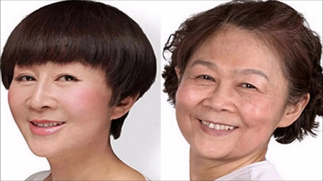 Top 9 Worst Celebrity Plastic Surgeries Bad celebrity plastic surgery, Celebrity