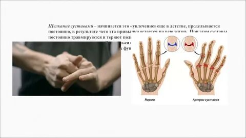 Щолканье или щелканье