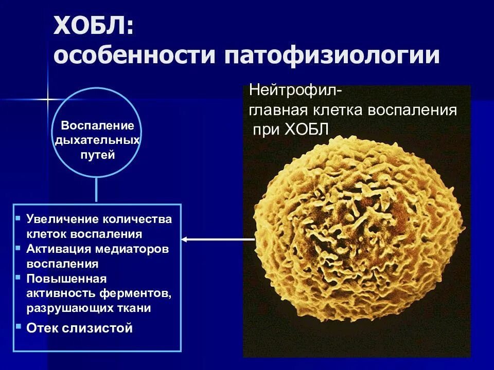 Бронхит хобл. Особенности ХОБЛ. ХОБЛ медиаторы воспаления. ХОБЛ патофизиология. Хронический бронхит патофизиология.