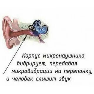 Застрял микронаушник