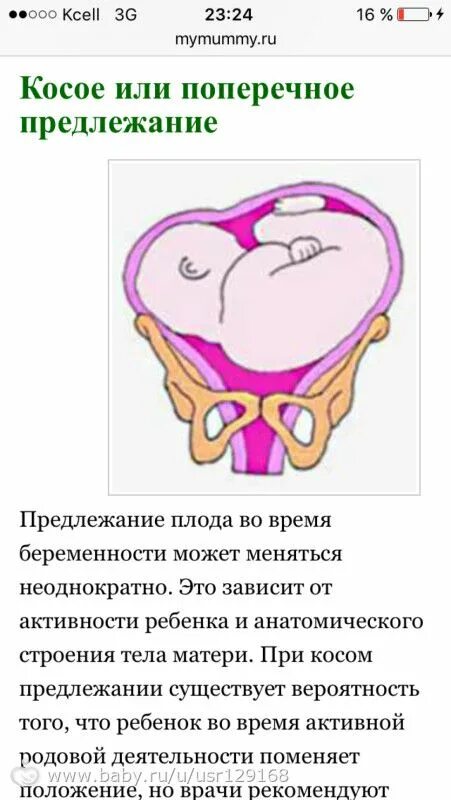 Беременность в поперечном положении