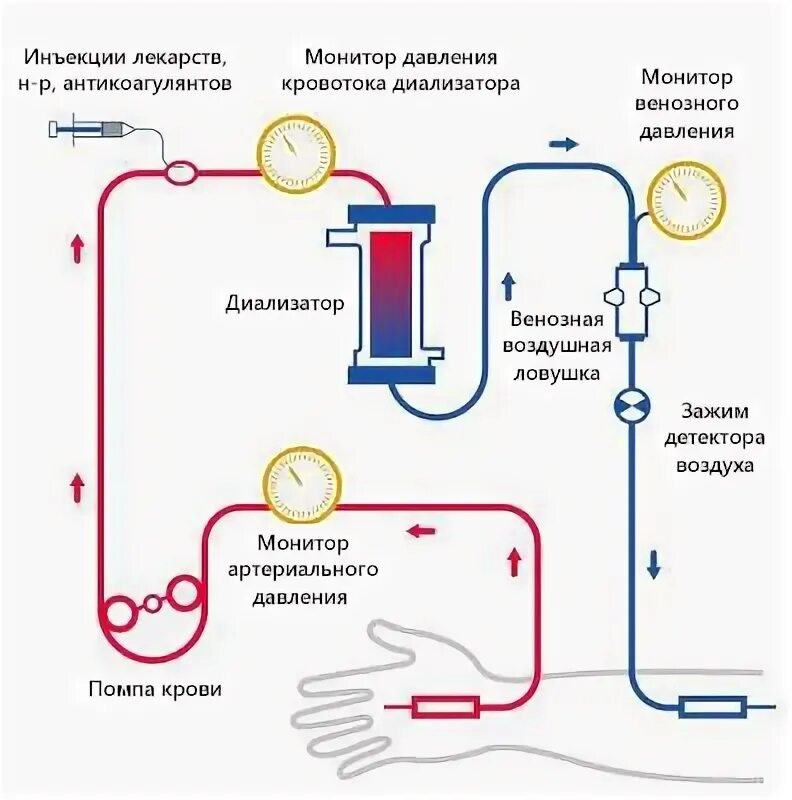Давление при гемодиализе