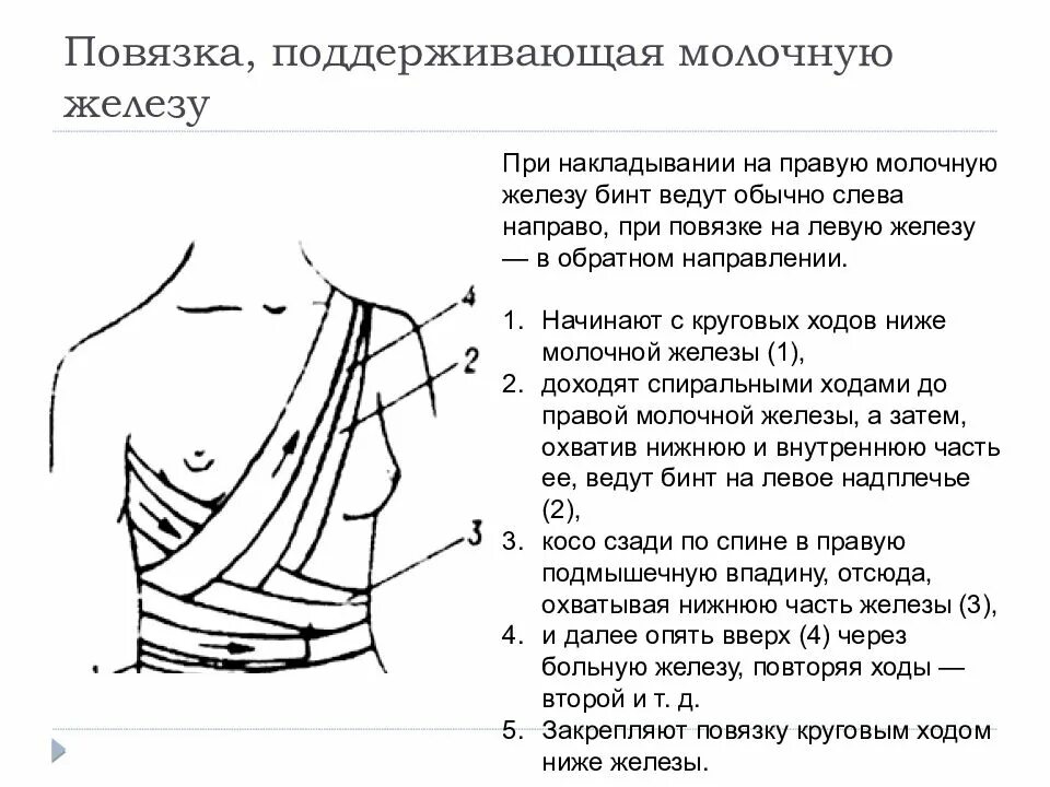 Наложите повязку на правую молочную железу.. Наложение повязки на правую молочную железу. Наложите бинтовую повязку на молочную железу.. Техника наложения повязки на правую молочную железу. Перевязать молоко