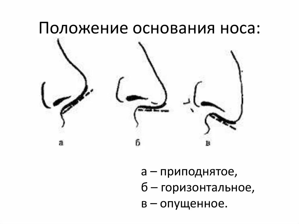 Какой размер носа. Основание носа габитоскопия. Положение носа криминалистика. Положение крыльев носа криминалистика. Форма кончика носа криминалистика.