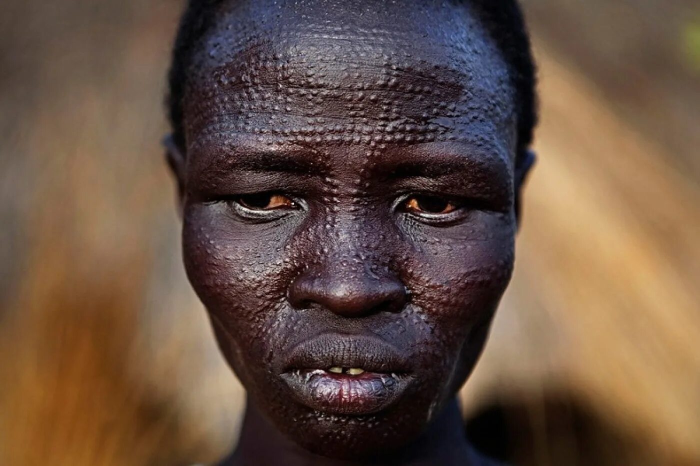 Лицо негроидной расы. Племя Динка шрамирование. Негроидная Африканская раса.