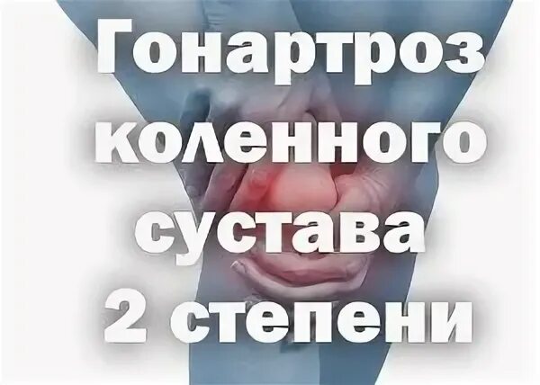 Мкб гонартроз коленного сустава