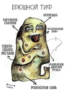 Брюшной тиф симптомы