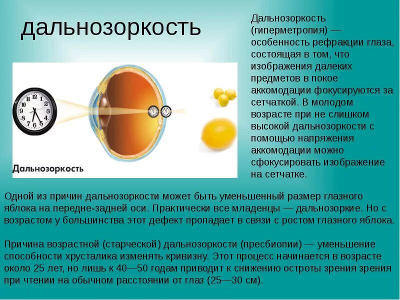 Близорукость презентация. Близорукость развивается при. Близорукость и дальнозоркость глазное яблоко. Близорукость миопия. Причина дефекта дальнозоркости.
