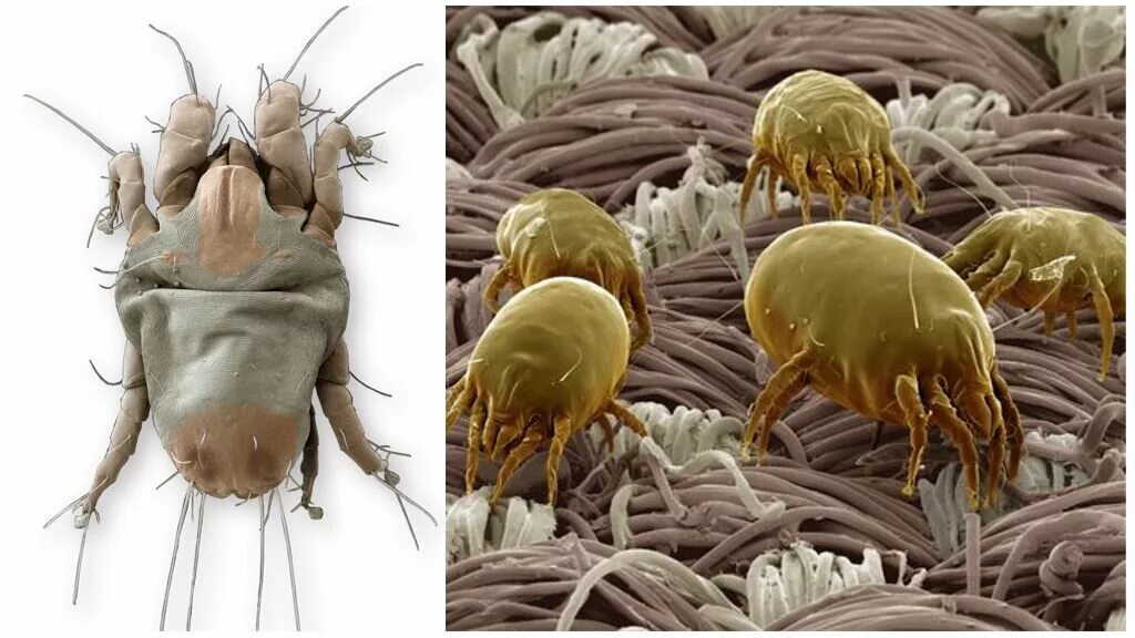 Сапрофиты пылевые клещи. Сапрофиты бельевые клещи. Пылевой клещ сапрофит.