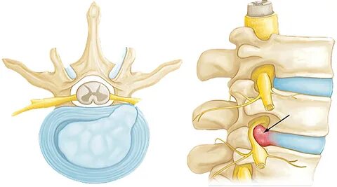 Articole - Kineto Solution