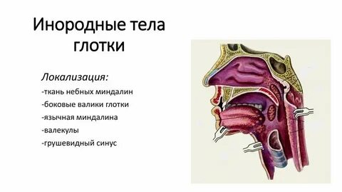 Носоглотка сообщения