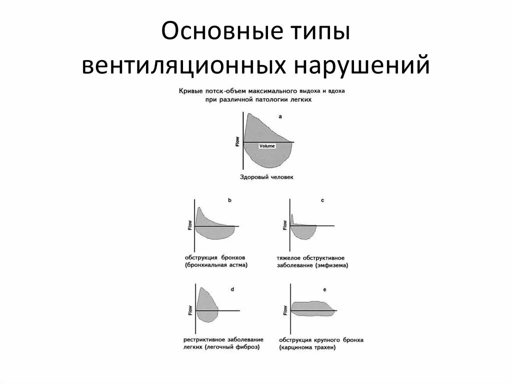 Обструктивный Тип вентиляционных нарушений характеризуется. Вентиляционные нарушения обструктивного типа. Вентиляционные нарушения обструктивного типа ФВД. Обструктивный Тип нарушения вентиляции.