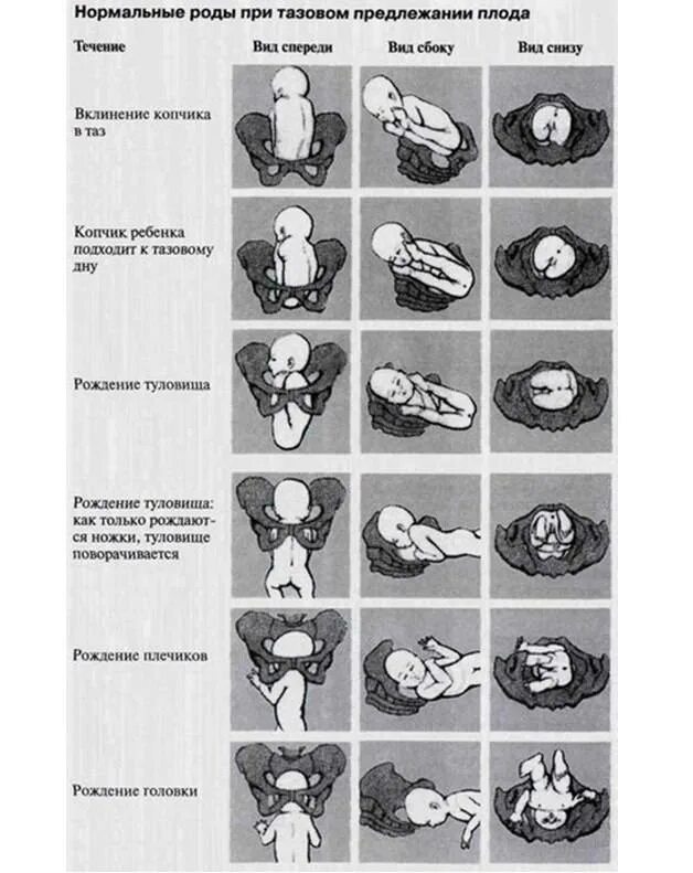 Ягодичное предлежание плода позиция 1. Тазовое предлежание 1 позиция передний вид. Головное косое предлежание плода. Продольное головное предлежание 2 позиция. Путь ребенка во время родов