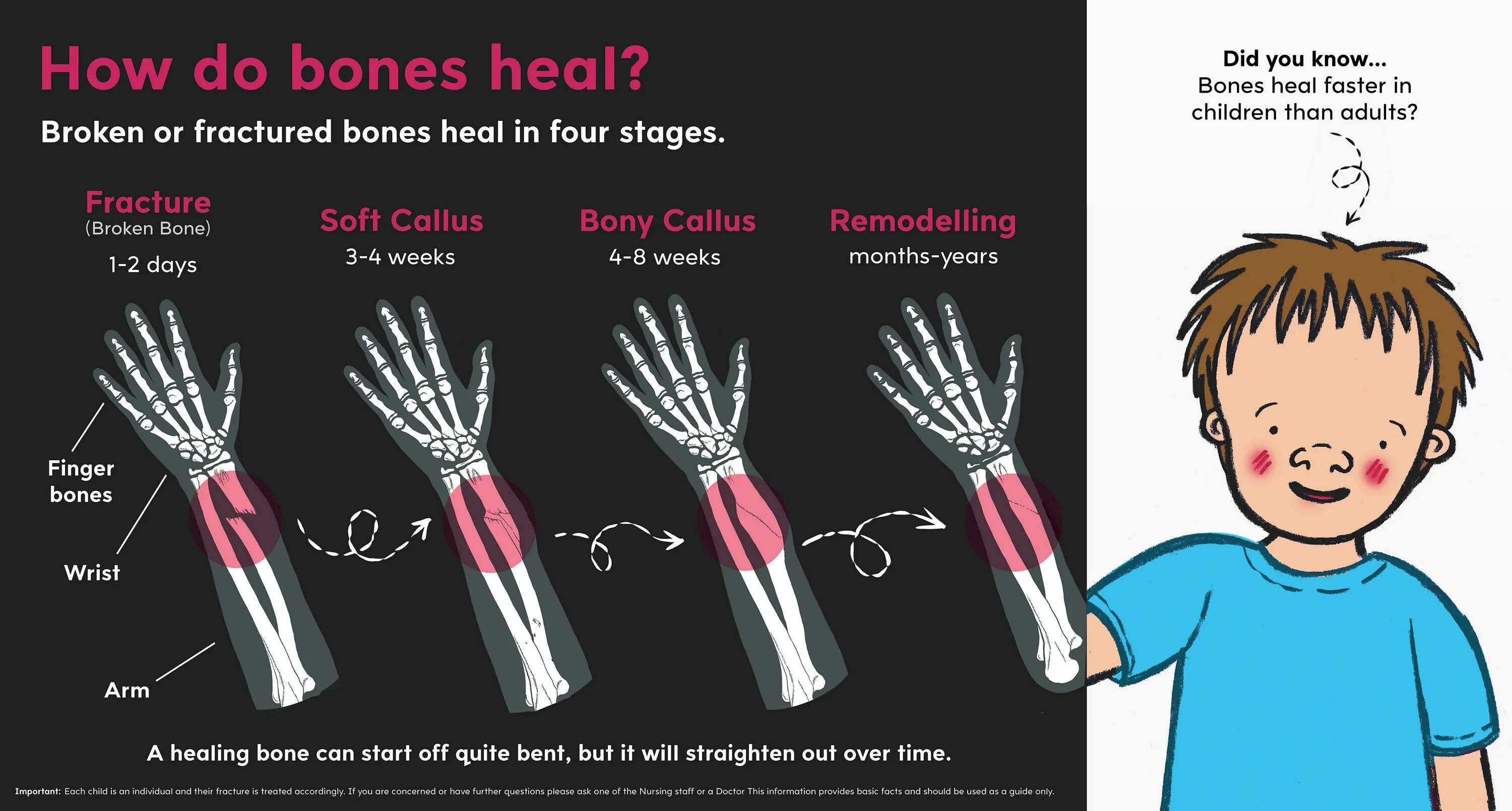 Bones how. Finger bones how much. early people used meat to heal broken bones. ответы.