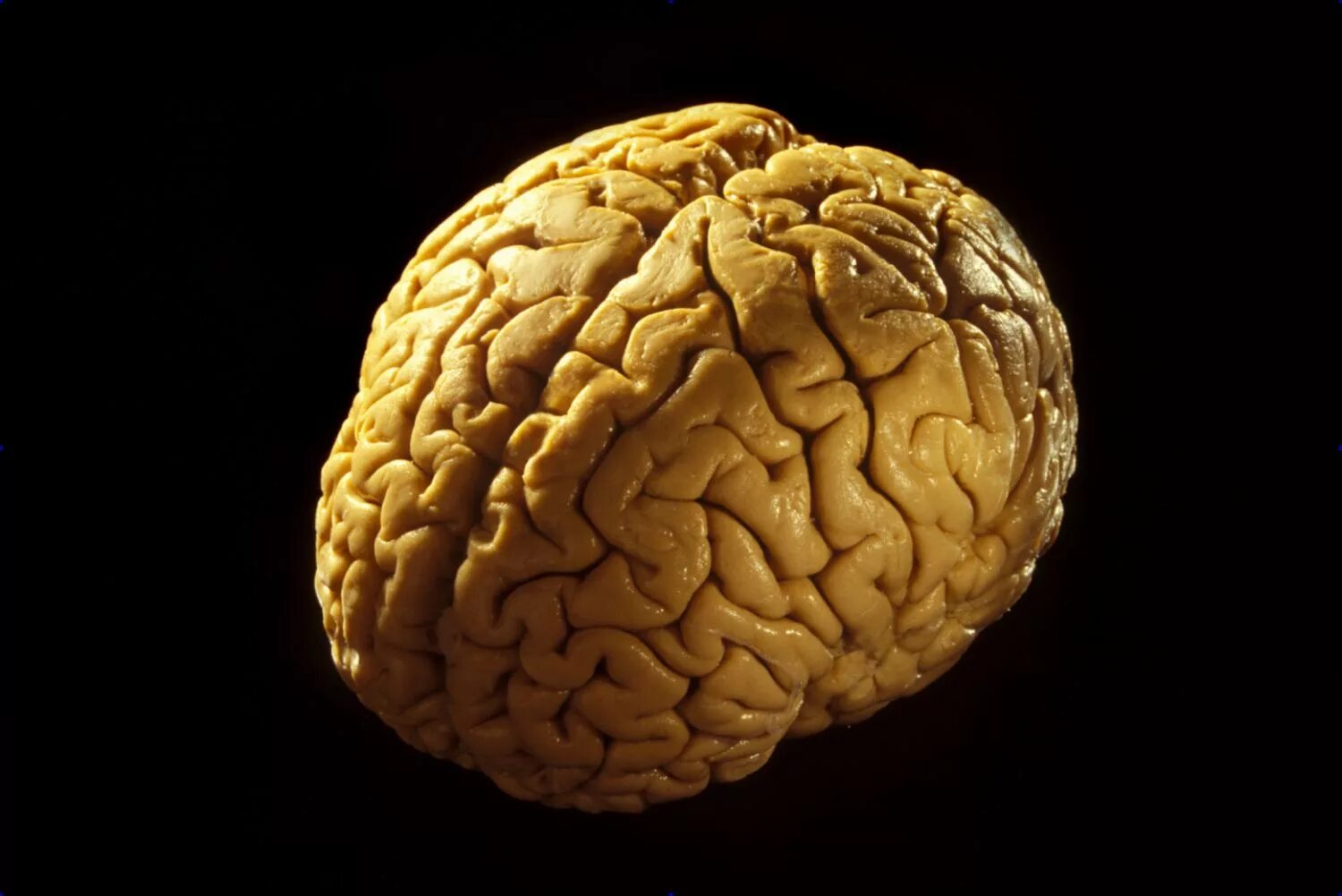 Современный мозг. Головной мозг. Изображение мозга.