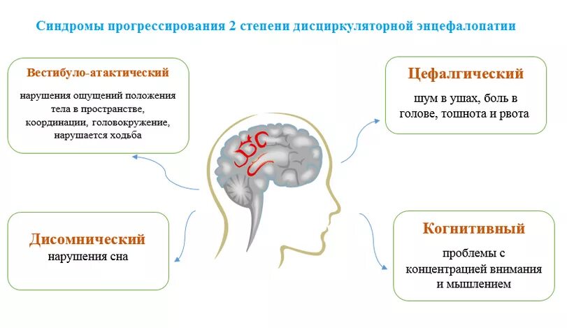 Вестибуло атактический синдром что это. Дисциркуляторная энцефалопатия 2 стадии. Дисциркуляторная энцефалопатия 2 степени энцефалопатия. Симптомы дисциркуляторной энцефалопатии 2 стадии. Энцефалопатия головного мозга что это такое.