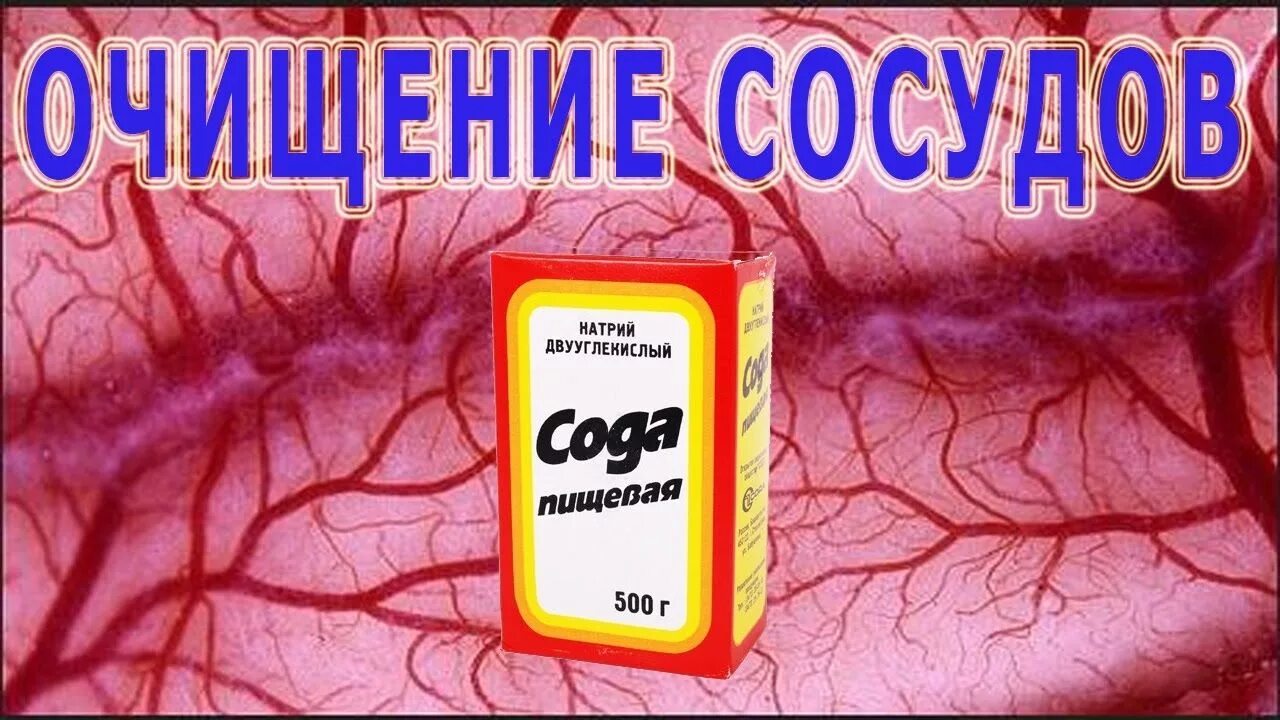 Чистка сосудов в домашних. Сода пищевая для чистки сосудов. Чистка артерий и сосудов. Чистка сосудов содой. Как очистить сосуды от тромбов народными