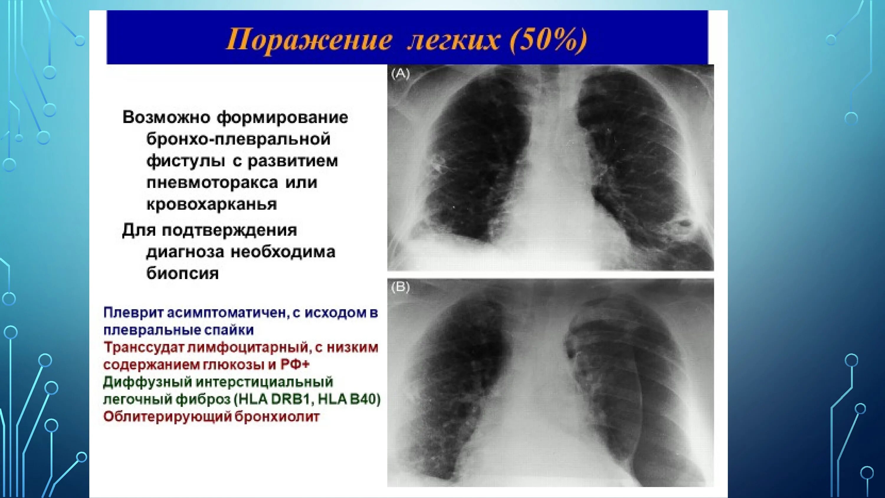 80 процентов поражение