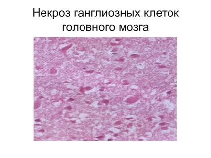 Некроз клетки