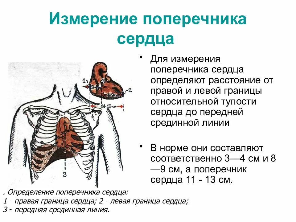 Сердечный узнать