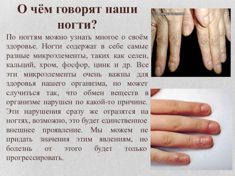 Как отличить болезнь. Ногти при различных заболеваниях. Болезни по ногтям на руках таблица. Определить болезнь по ногтям.