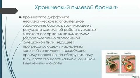 Заболевание бронхов