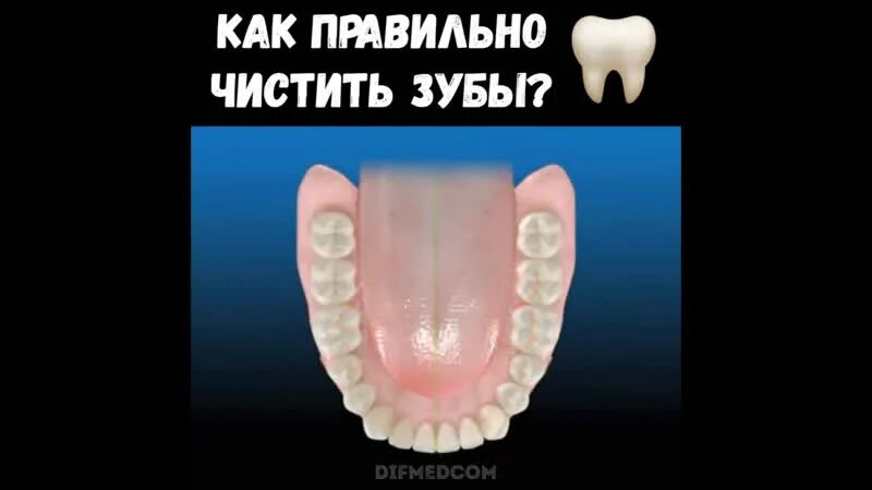 Число каналов в зубах. 15 Зуб каналы.