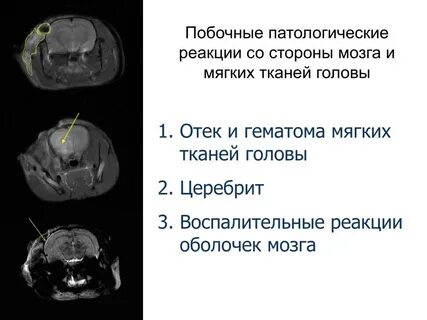 Мягкие ткани головы