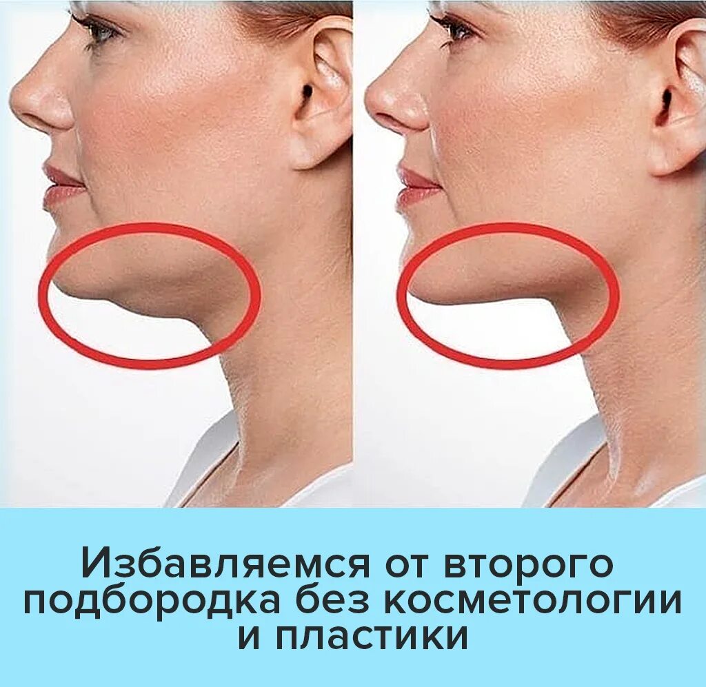 Растет подбородок у женщины причины. Упражнения для второго подбородка. упражнения для избавления от второго подбородка. липолитики подбородок брыли. липолитики для лица от второго подбородка.
