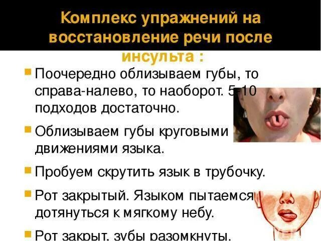 Задания после инсульта для восстановления речи. Логопедические упражнения после инсульта. Упражнения для речи после инсульта. Задания после инсульта для восстановления речи. Речевая гимнастика при ишемическом инсульте.