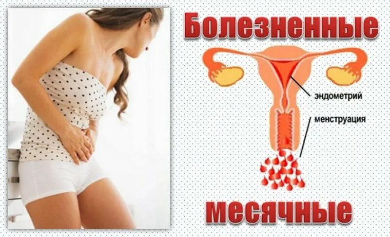 Иногда нет месячных. Болезненные месячные. болит живот примемячных. болит живот месячные. боли при месячных.