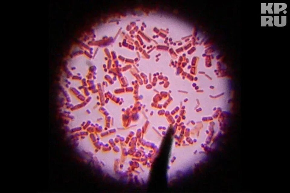 Бактерия сальмонелла Тифи. Salmonella typhi микроскопия. Возбудитель брюшного тифа микробиология. Сальмонелла брюшного тифа. Сальмонеллез и брюшной тиф