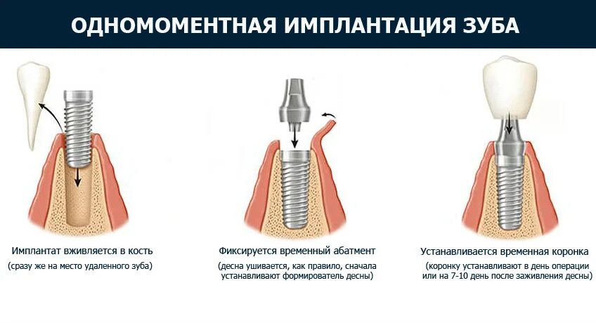 Заключающаяся в удалении