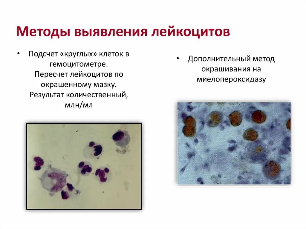 Реактивные изменения лейкоцитов. Методы изучения лейкоцитов. Лабораторные методы исследования лейкоцитов. Лейкоциты в эякуляте. Методы исследования при лейкоцитах.