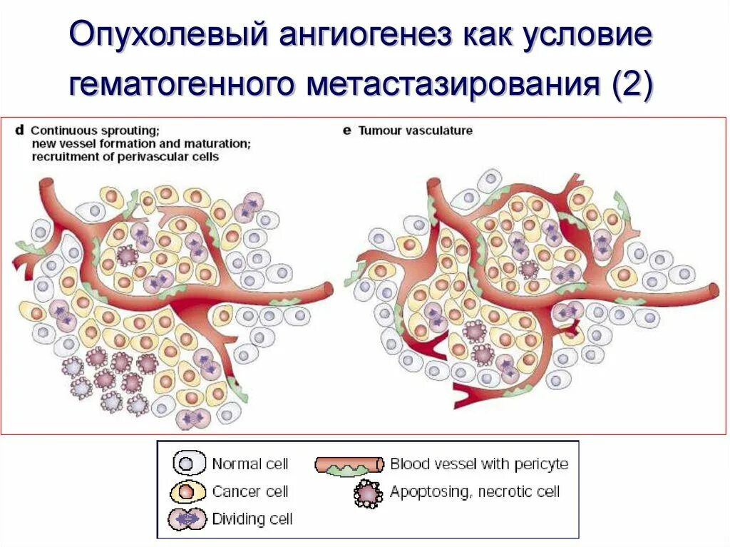 Гематогенное метастазирование