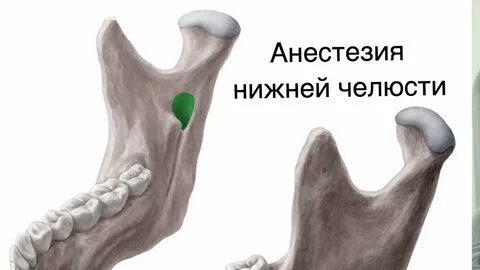Анестезии на нижней