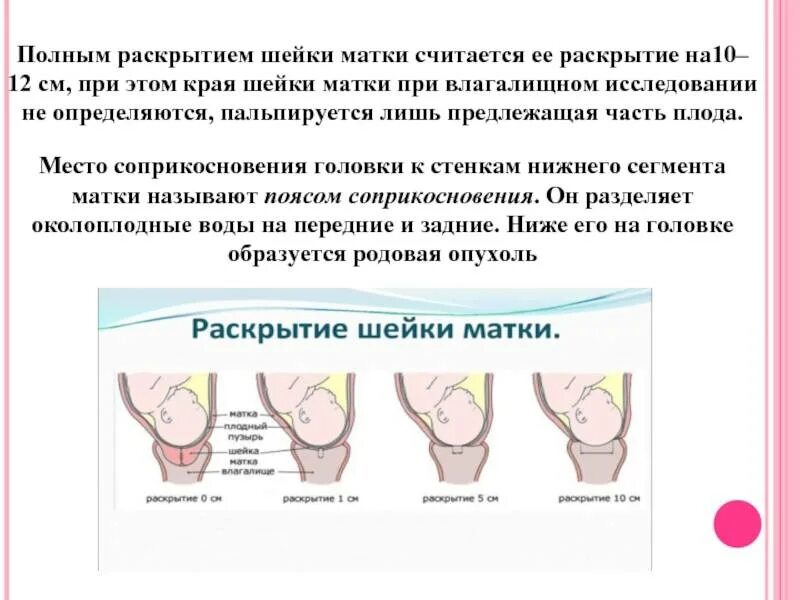 Раскрытие шейки. Шейка матки перед родами. Раскрытие шейки матки перед родами.