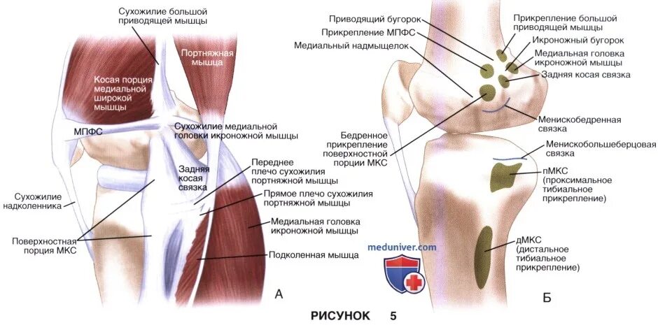 Латеральная коллатеральная связка коленного. Коллатеральная связка коленного сустава. Медиальная коллатеральная связка коленного сустава. Разрыв боковой коллатеральной связки коленного сустава. Наружная коллатеральная связка коленного сустава растяжение.