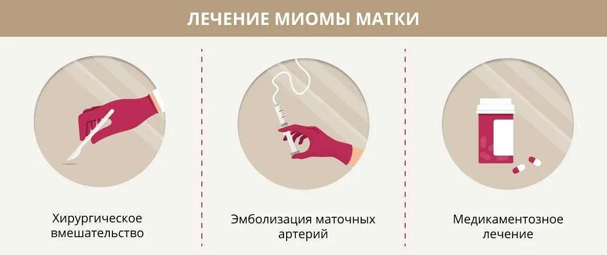 Лечение миомы матки без операции после. Эмболизация миомы матки лекарственными препаратами. упражнения для уменьшения миомы матки. тампоны при миоме матки.