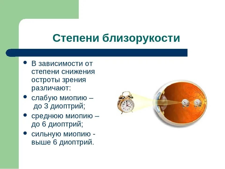 Зрение миопия слабой степени. Миопия слабой средней степени. Близорукость 4 степени. Миопия средней степени при дальнозоркости. Слабая миопия глаза что