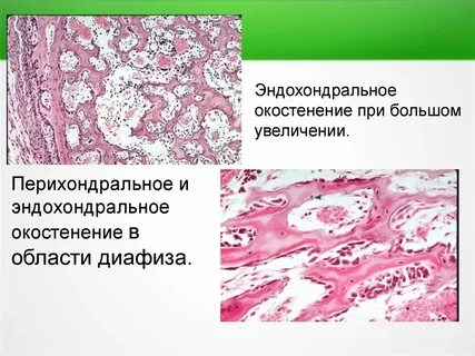 Перихондральное окостенение при непрямом остеогенезе