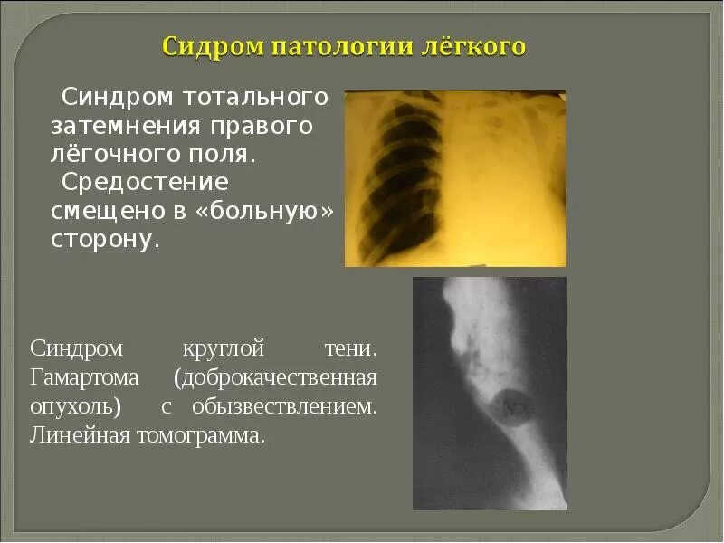 Как ты понимаешь что такое затемнение. Как ты понимаешь что такое затемнение
