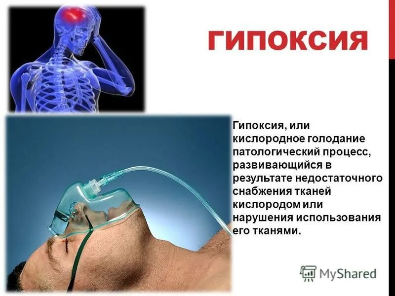 Кислород не поступает в мозг