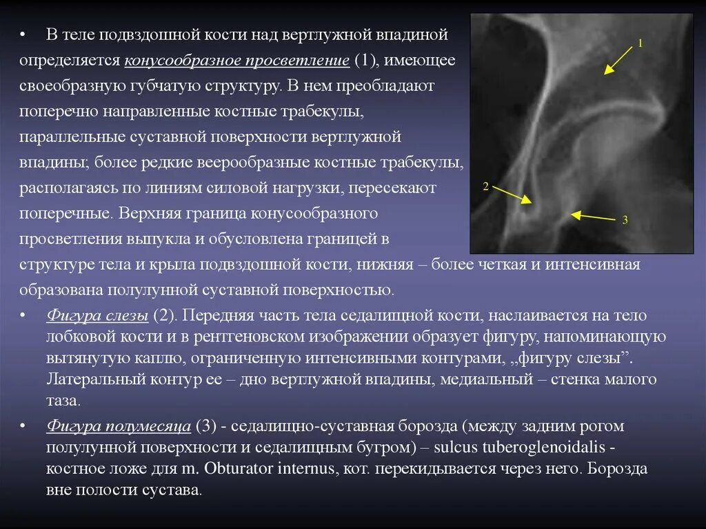Сакроилеит тазобедренного сустава на рентгене. Склероз подвздошной кости. Остеосклеротический очаг в подвздошной кости. Мрт крестца сакроилеит. Склероз подвздошной кости.