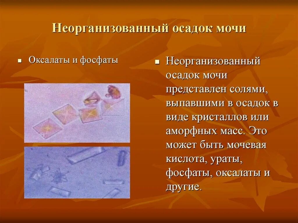 Фосфаты в моче у мужчин. Неорганизованный осадок в моче. Организованный и неорганизованный осадок мочи. Неорганизованнвй очдаок Сочи. Таблица организованные осадки мочи.