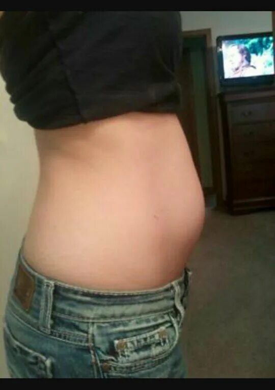 11 недель беременности 2 беременность. Живот на 7 неделе беременности двойней. Живот на 10 неделе беременности двойней. Живот на 11 неделе беременности двойней. 10 Акушерская неделя беременности живот.