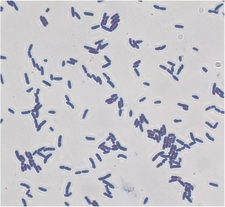 Eubacterium limosum. Эубактерии микробиология. Эубактериум в мазке. Бактерии эубактерии.