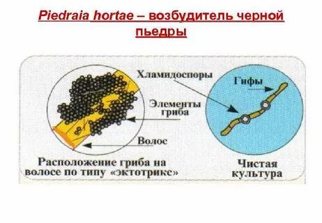 Черный возбудитель