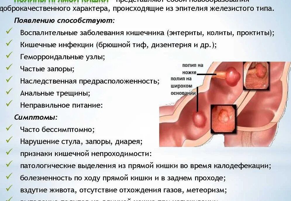 Наличие внутри